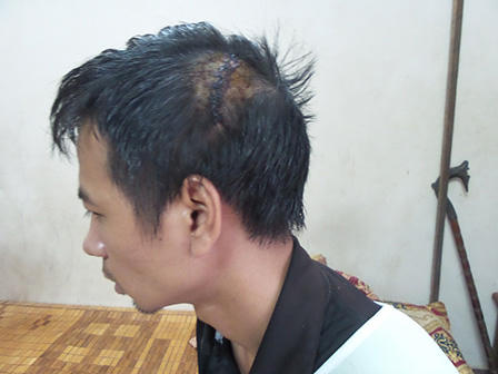 Công an vào cuộc vụ gần 20 “côn đồ” hành hung cả nhà chủ nợ